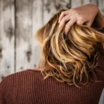 thinninghairhairlossinwomen